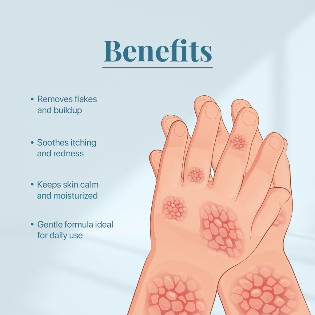 Siya Ayurveda Psoria Body Wash