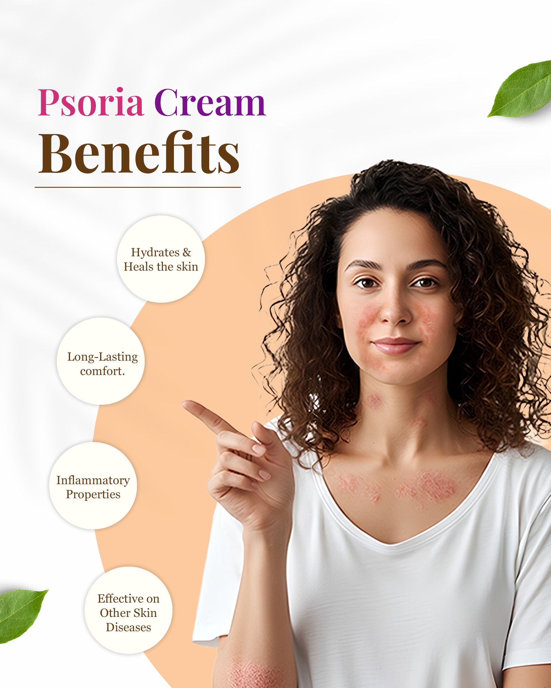 Siya Ayurveda Psoria Cream: Cream for psoriasis